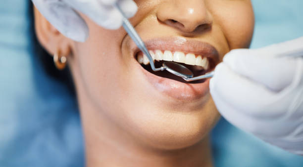 Best Emergency Tooth Extraction in Naples, FL